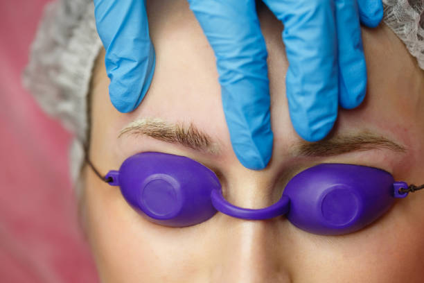 Antakių naikinimas lazariu